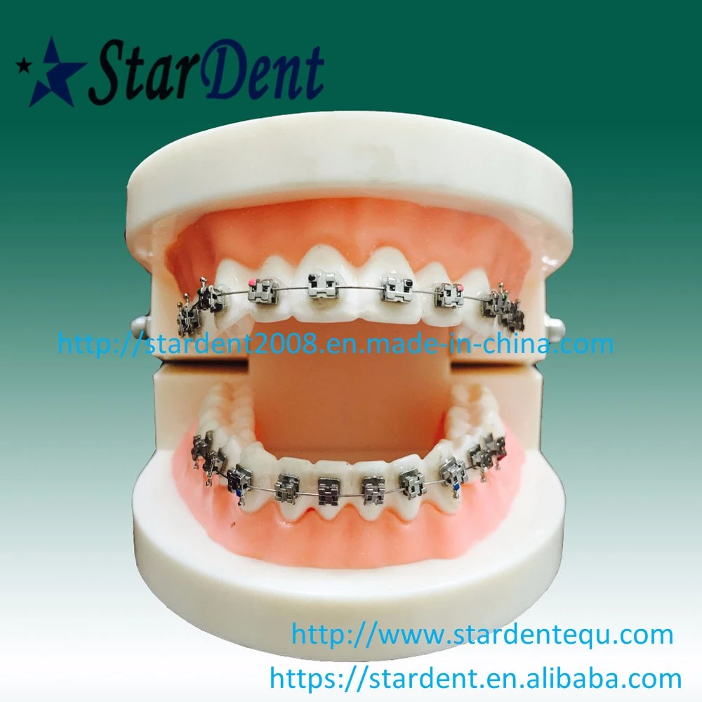 Dental Orthodontic Self Ligating Metal Brackets with Ce FDA